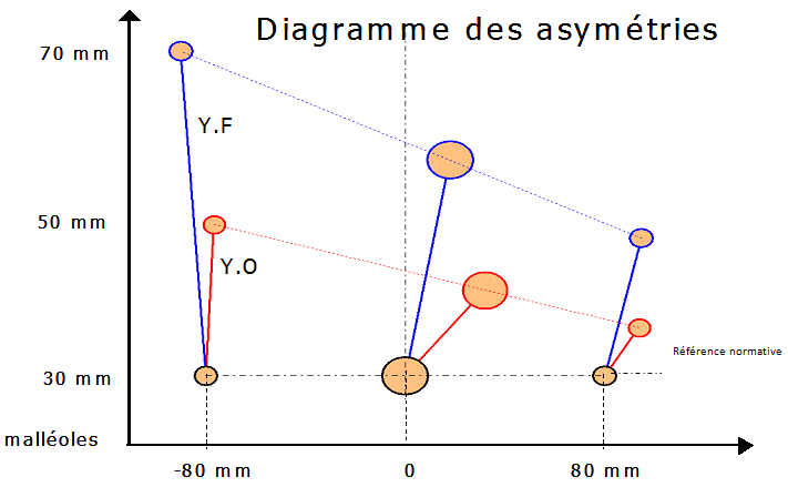 Pedana Stabilometrica Cyber-Sabots - Diagramme delle asimmetrie