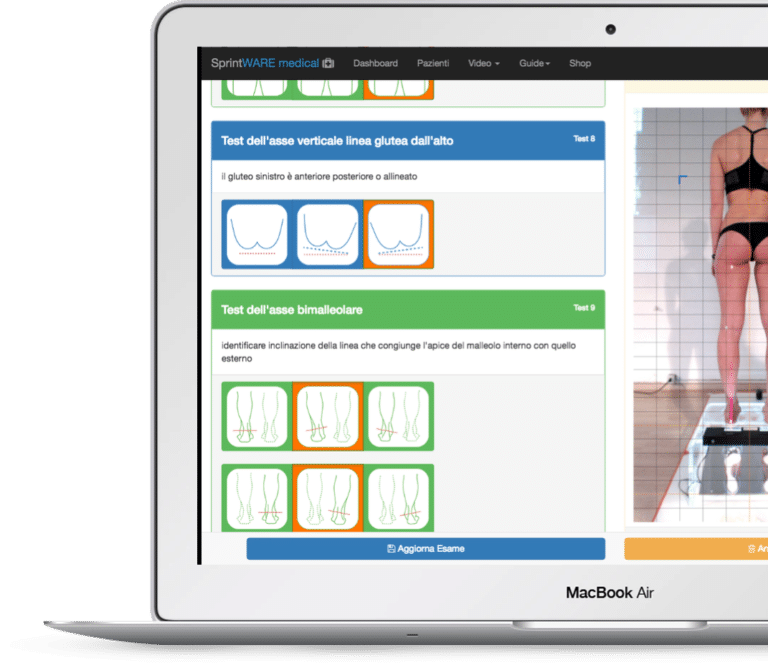 Sprintware Medical - Esame al Podoscopio