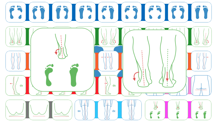 Rubriche – Valutare il piede in ottica posturale