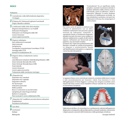 Craniodonzia - Giuseppe Stefanelli - Indice del libro