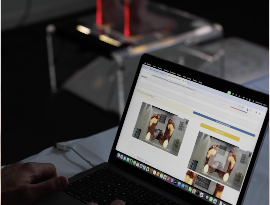 Misurazione posturale eseguita con SprintWARE