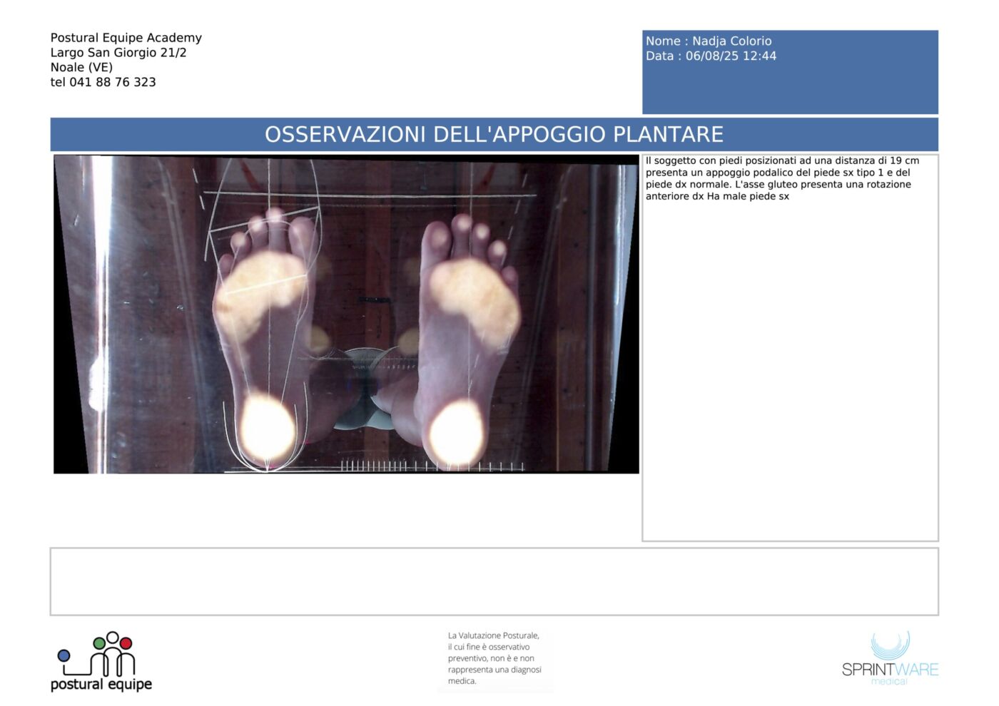 Report reale: osservazioni dell&rsquo;appoggio plantare